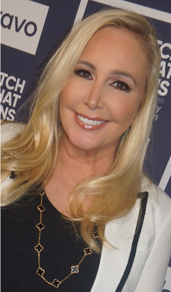 Shannon Beador's Makeup On Watch What Happens Live